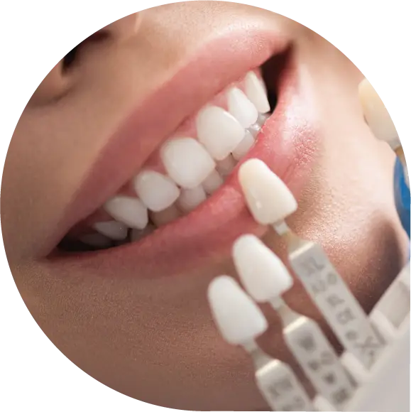 Teeth Whitening cosmetic dentistry