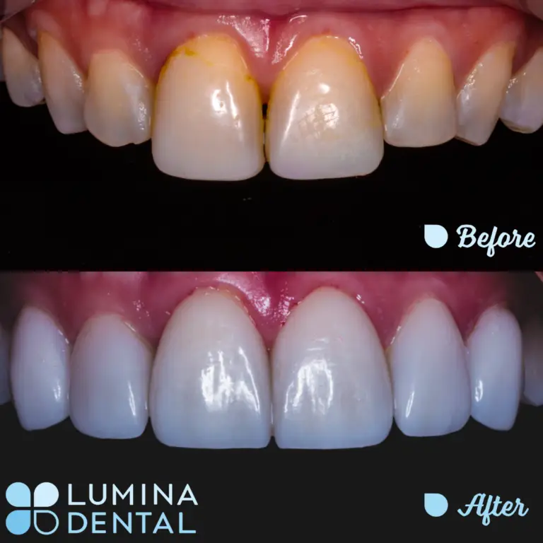 Dentist Sydney CBD - Lumina Dental